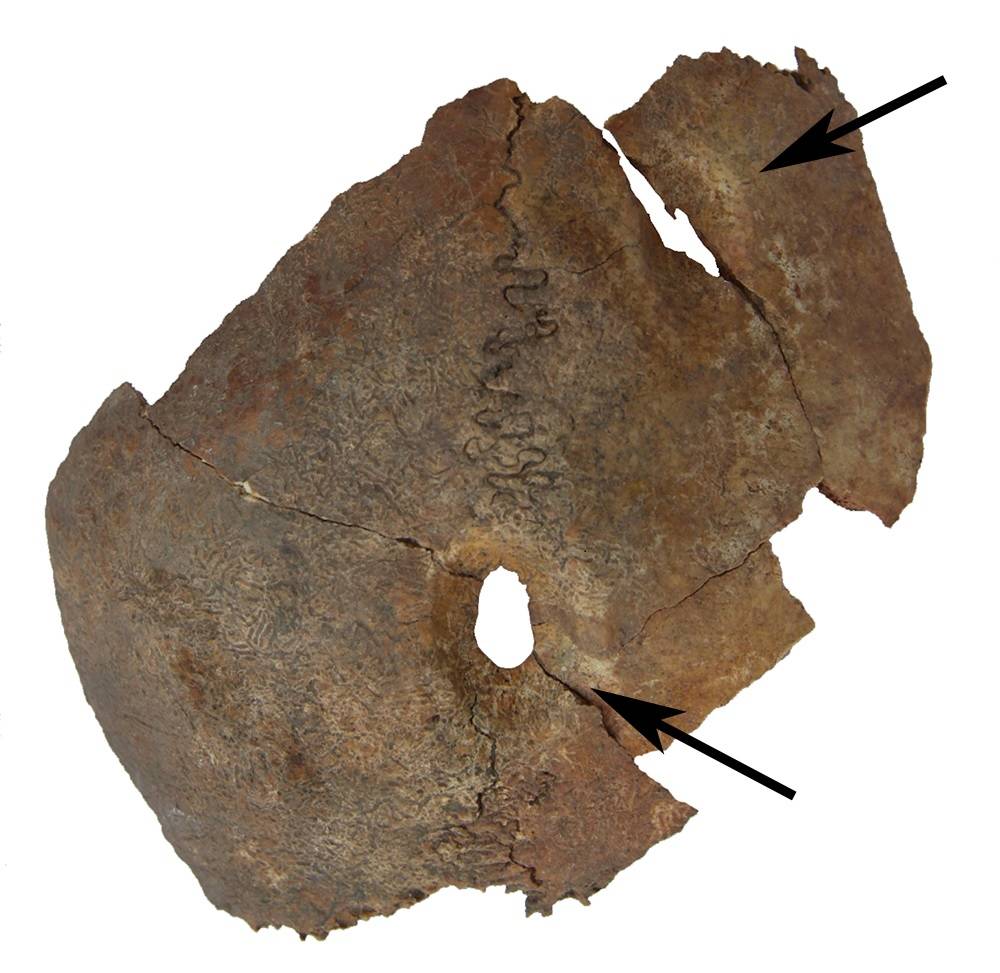 Нашли доисторическую девушку 40 миллионов лет. Перуанские трепанированные черепа со следами заживления. Следы осколков ГМИИ.