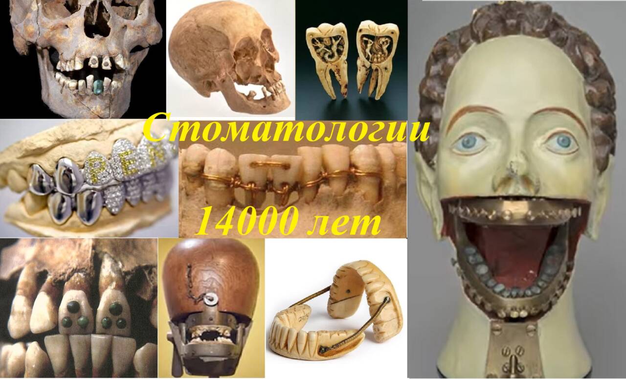 древняя стоматология